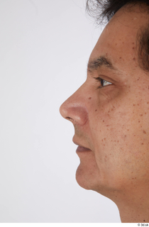 Photos of Cristian Andrade nose 0002.jpg